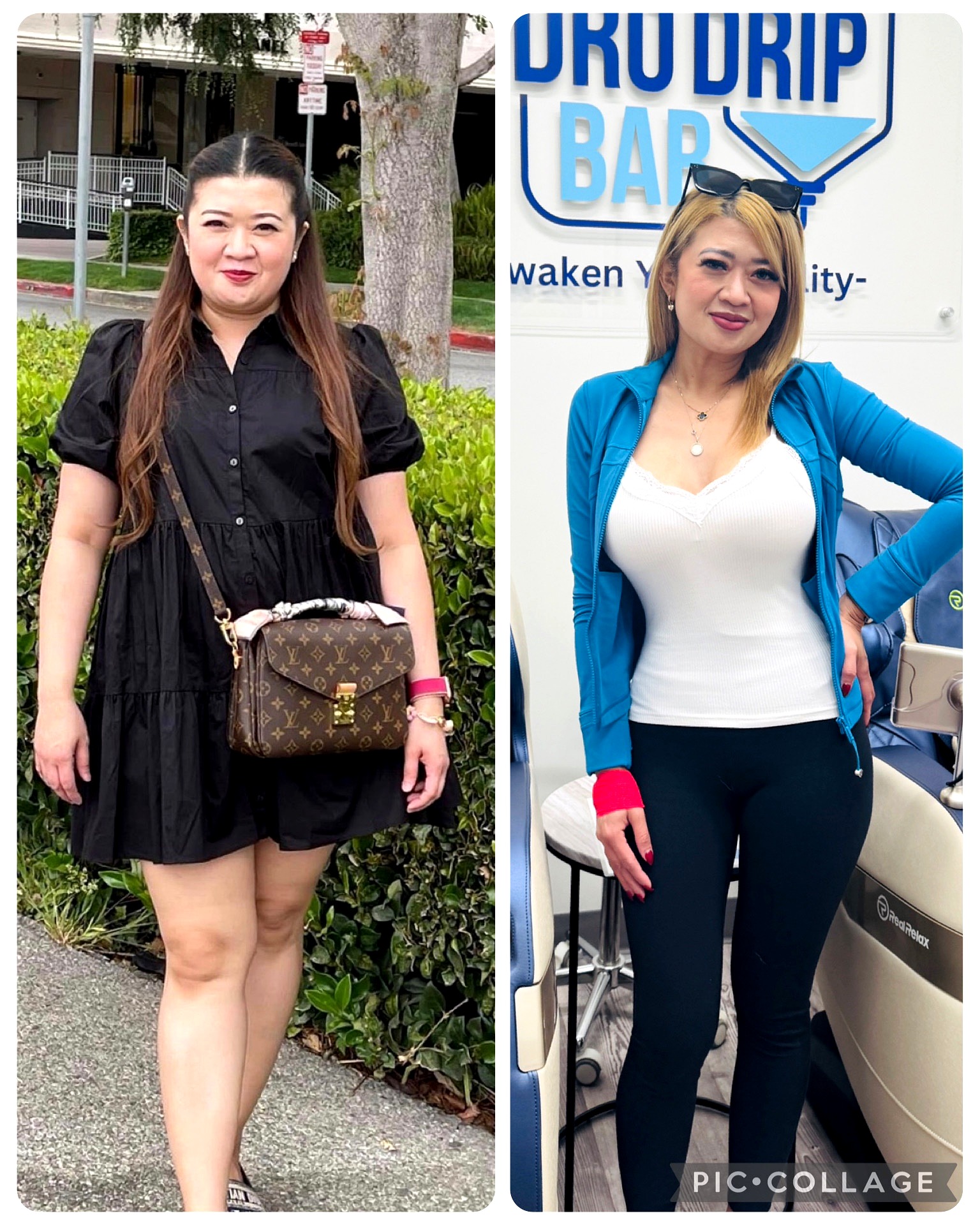 Client transformation — before and after GLP-1 weight loss at The Hydro Drip Bar